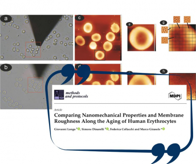 Comparing Nanomechanical Properties and Membrane Roughness Along the Aging of Human Erythrocytes